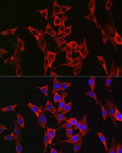 Immunofluorescence analysis of NIH/3T3 cells using Anti-FGFR3 Antibody (A8397) at a dilution of 1:100 (40X lens). DAPI was used to stain the cell nuclei (blue)