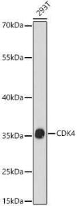 Western blot analysis of extracts of 293T cells, using Anti-Cdk4 Antibody (A309050) at 1:1,000 dilution. The secondary antibody was Goat Anti-Rabbit IgG H&L Antibody (HRP) at 1:10,000 dilution.