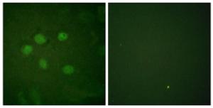 Antibody anti-AOS1 100 µg