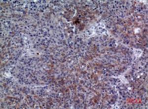 Immunohistochemical analysis of paraffin-embedded human lung using Anti-LILRA1 Antibody