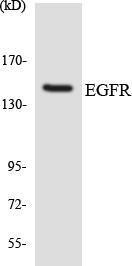 Western blot analysis of the lysates from HT 29 cells using Anti-EGFR Antibody