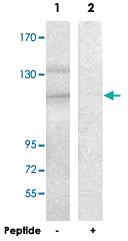 Anti-SDCCAG1 Rabbit Polyclonal Antibody