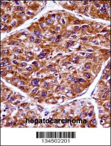 Anti-EIF2AK3 Rabbit Polyclonal Antibody