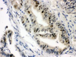 Anti-VDR Rabbit Polyclonal Antibody