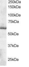 Antibody anti-TXNRD1 100 µg