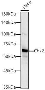 Western blot analysis of HeLa, using Anti-Chk2 Antibody [ARC57076] (A306128) at 1:7,000 dilution. The secondary antibody was Goat Anti-Rabbit IgG H&L Antibody (HRP) at 1:10,000 dilution.