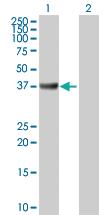 Anti-ADA Rabbit Polyclonal Antibody