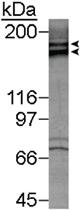 Anti-KDR Rabbit Polyclonal Antibody