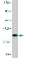 Anti-TRA Mouse Monoclonal Antibody [clone: 4H8]