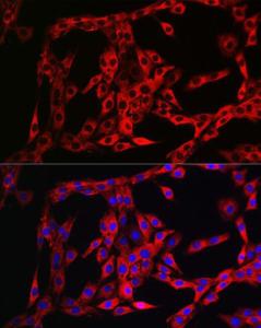 Immunofluorescence analysis of PC-12 cells using Anti-FGFR3 Antibody (A8397) at a dilution of 1:100 (40X lens). DAPI was used to stain the cell nuclei (blue)