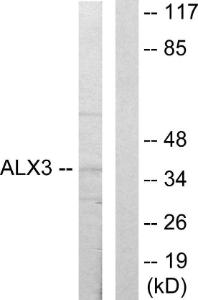 Western blot analysis of lysates from 293 cells using Anti-ALX3 Antibody The right hand lane represents a negative control, where the antibody is blocked by the immunising peptide