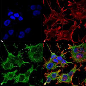 Immunocytochemistry/Immunofluorescence analysis of human neuroblastoma cell line (SK-N-BE, fixed in 4% formaldehyde for 15 min at room temperature, using Anti-SLC38A1/NAT2 Antibody [S104-32] (A305004), at 1:100 for 60 minutes at room temperature