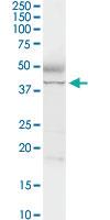 Anti-ADA Rabbit Polyclonal Antibody