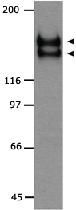 Anti-KDR Rabbit Polyclonal Antibody