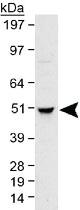 Anti-TUBB Rabbit Polyclonal Antibody