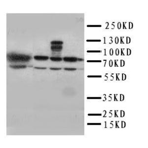 Anti-HSPA2 Rabbit Polyclonal Antibody