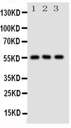 Anti-GLUT5 Rabbit Polyclonal Antibody