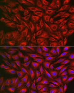 Immunofluorescence analysis of U2OS cells using Anti-FGFR3 Antibody (A8397) at a dilution of 1:100 (40X lens). DAPI was used to stain the cell nuclei (blue)