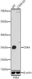 Western blot analysis of extracts from wild type (WT) and CDK4 knockout (KO) HeLa cells, using Anti-Cdk4 Antibody (A309050) at 1:1,000 dilution. The secondary antibody was Goat Anti-Rabbit IgG H&L Antibody (HRP) at 1:10,000 dilution.