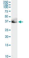 Anti-ADA Rabbit Polyclonal Antibody