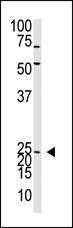 Anti-NEUROG2 Rabbit Polyclonal Antibody (AP (Alkaline Phosphatase))