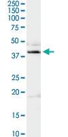 Anti-ADA Rabbit Polyclonal Antibody