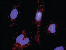 Anti-XIAP + RAF1 Antibody Pair