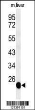 Anti-BSND Rabbit Polyclonal Antibody (FITC (Fluorescein Isothiocyanate))