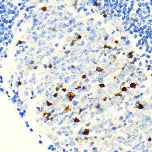 Immunohistochemistry analysis of paraffin-embedded human appendix tissue using Anti-Parvalbumin Antibody [ARC0385] (A307807) at a dilution of 1:100 (40x lens)