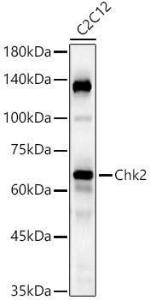 Western blot analysis of C2C12, using Anti-Chk2 Antibody [ARC57076] (A306128) at 1:7,000 dilution. The secondary antibody was Goat Anti-Rabbit IgG H&L Antibody (HRP) at 1:10,000 dilution.