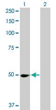 Anti-PPM1F Rabbit Polyclonal Antibody