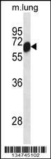 Anti-CLK2 Rabbit Polyclonal Antibody (Biotin)