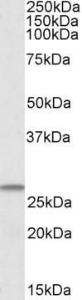 Anti-CHCHD3 Antibody (A84772) (1 µg/ml) staining of Human Heart lysate (35 µg protein in RIPA buffer) Primary incubation was 1 hour Detected by chemiluminescence