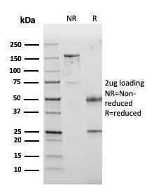 SDS-PAGE analysis of Anti-PD-L1 Antibody [PDL1/2745] under non-reduced and reduced conditions; showing intact IgG and intact heavy and light chains, respectively. SDS-PAGE analysis confirms the integrity and purity of the antibody