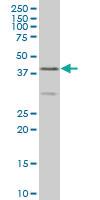 Anti-ELF3 Mouse Monoclonal Antibody [clone: 1F12]