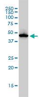 Anti-ADA Mouse Monoclonal Antibody [clone: 4G4-1C6]