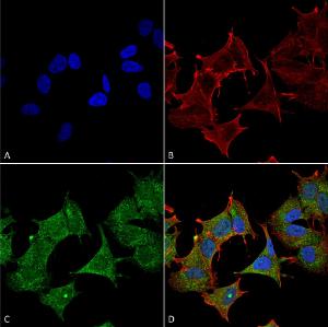 Immunocytochemistry/Immunofluorescence analysis of human neuroblastoma cell line (SK-N-BE, fixed in 4% formaldehyde for 15 min at room temperature, using Anti-ULK3 Antibody (A305005), at 1:100 for 60 minutes at room temperatur