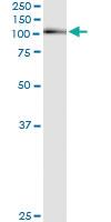 Anti-AHR Antibody Pair