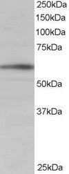 Anti-BAIAP2 Antibody (A83176) staining (1 µg/ml) of Human Brain lysate (RIPA buffer, 35 µg total protein per lane). Primary incubated for 1 hour. Detected by chemilu minescence