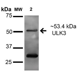 Western blot analysis of human lung carcinoma epithelial cell line (A549) lysate showing detection of 53.4 kDa ULK3 protein using Anti-ULK3 Antibody (A305005) at 1:1,000 for 16 hours at 4°C. Lane 1: Molecular Weight Ladder (MW). Lane 2: human A549 cell