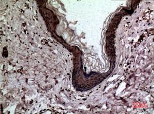 Immunohistochemical analysis of paraffin-embedded human skin using Anti-LGALS3 Antibody