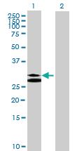 Anti-TPSAB1 Mouse Polyclonal Antibody