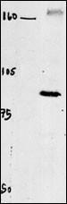 Anti-CLCN4 Rabbit polyclonal antibody