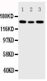 Anti-IGF1 Receptor Rabbit Polyclonal Antibody