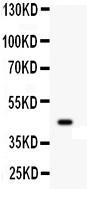 Anti-WNT2B Rabbit Polyclonal Antibody