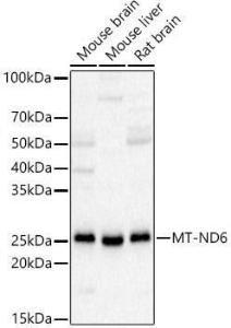 Western blot analysis of various lysates, using Anti-ND6 Antibody (A92852) at 1:2,000 dilution The secondary antibody was Goat Anti-Rabbit IgG H&L Antibody (HRP) at 1:10,000 dilution Lysates/proteins were present at 25 µg per lane