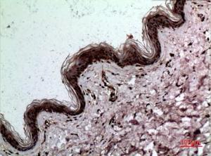 Immunohistochemical analysis of paraffin-embedded human skin using Anti-LGALS3 Antibody