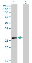 Anti-ELF5 Mouse Monoclonal Antibody [clone: 3D10]