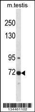 Anti-CLK3 Rabbit Polyclonal Antibody (FITC (Fluorescein Isothiocyanate))