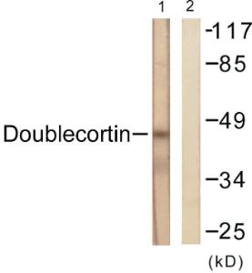 Anti-Doublecortin antibody